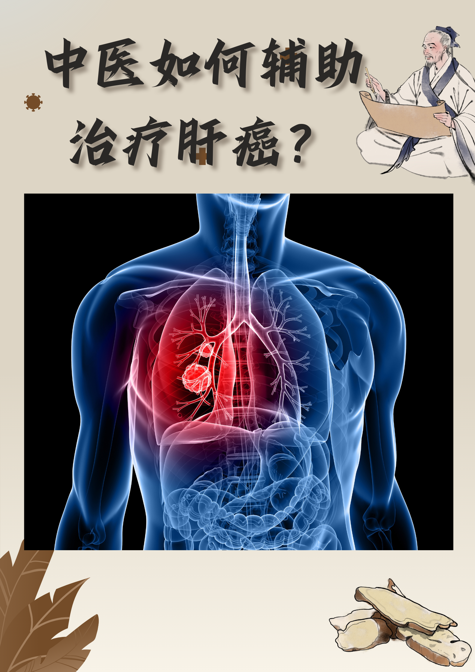 肝癌,作为全球范围内致死率极高的恶性肿瘤之一,其治疗一直是医学