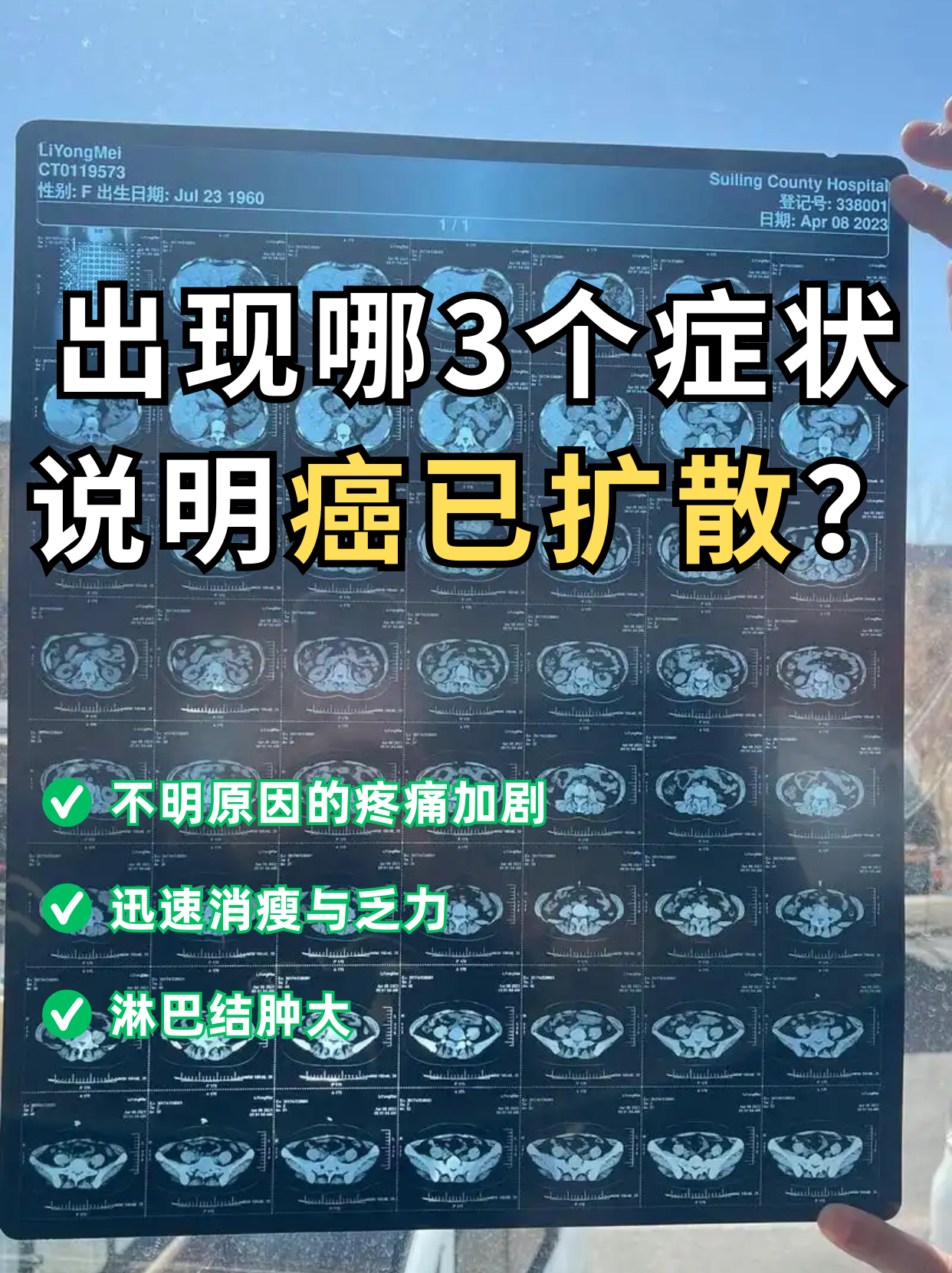 这3个症状注意了!