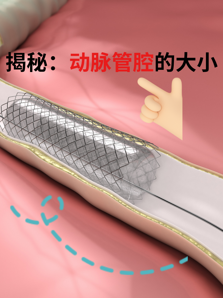 动脉是血液从心脏输送到身体各部位的管道,那么动脉管腔是大还是小呢?