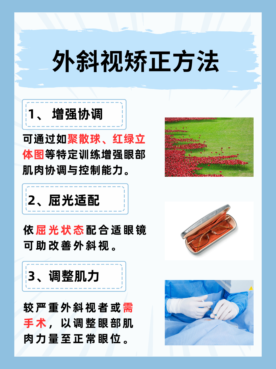 👉外斜视怎么办?教你几招矫正方法!