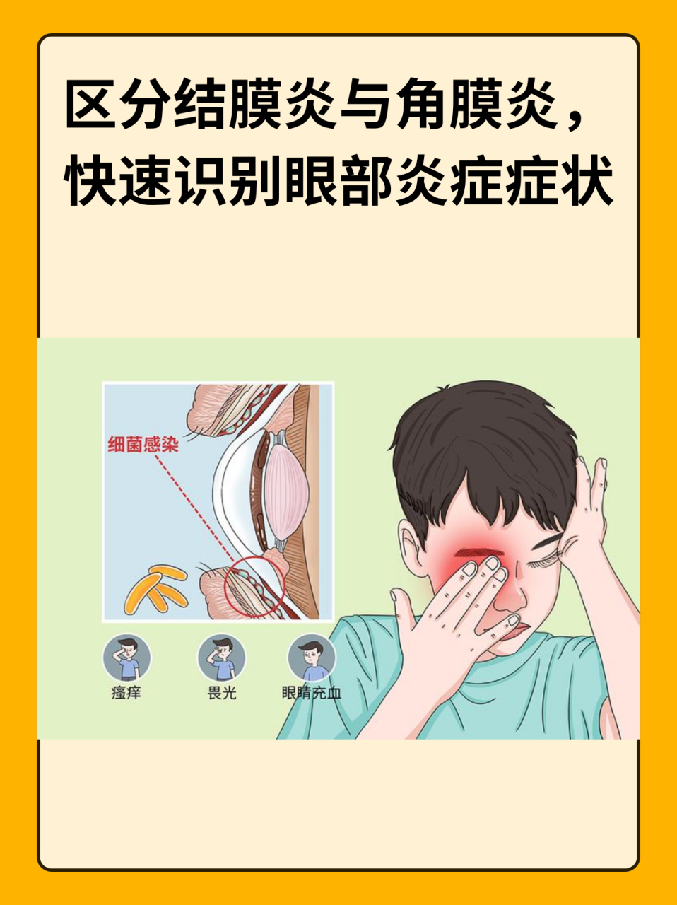 97区分结膜炎与角膜炎,快速识别眼部炎症症状 67结膜炎和角膜炎都