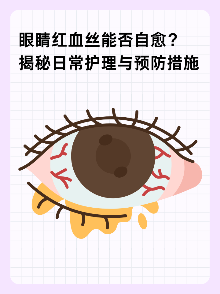 眼睛为什么会红出现血丝为什么在线