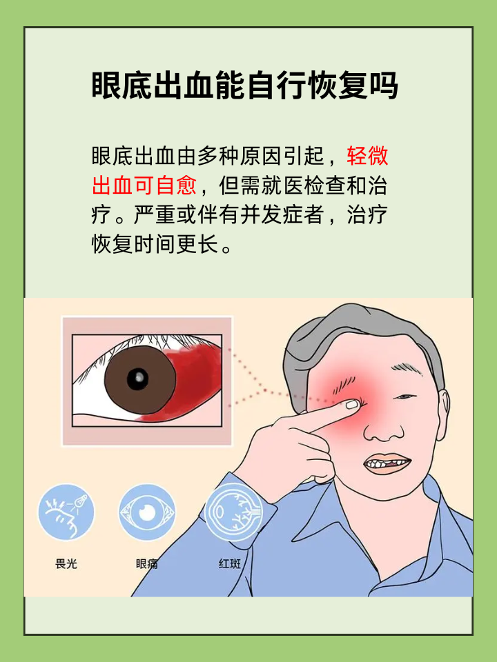 如果需要治疗,有哪些方法可以有效促进眼底出血的恢复?