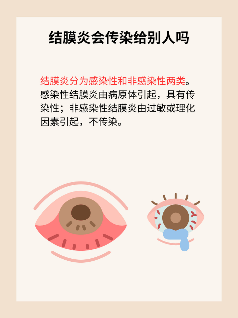 97结膜炎会传染给他人吗?防护措施需知否?