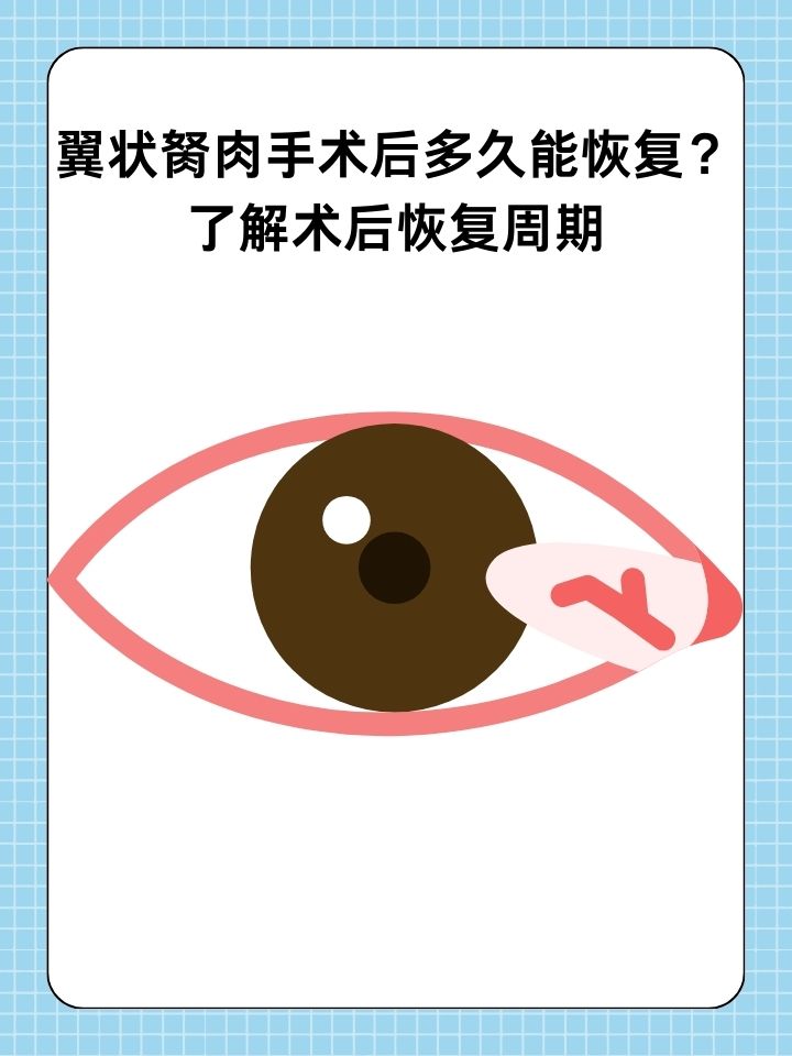 那么,翼状胬肉手术后,患者何时能恢复正常生活呢?