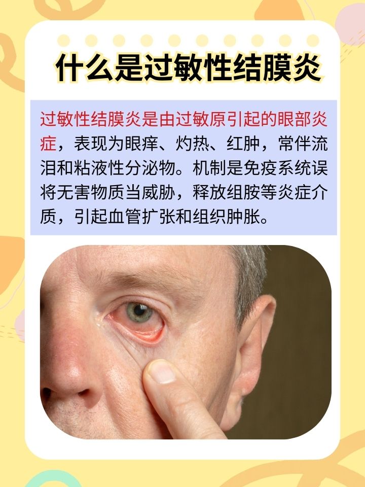 湿疹眼睛为什么会肿