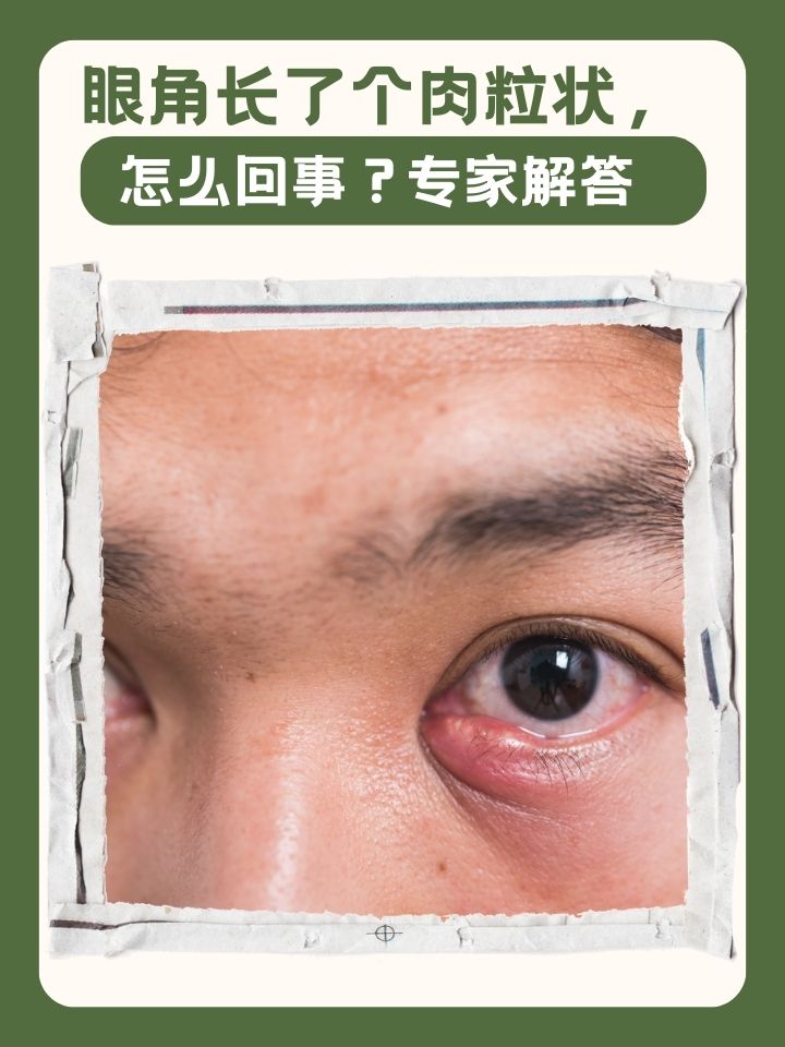 为什么眼角会痛