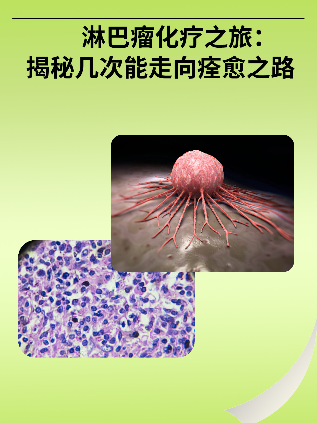 淋巴瘤化疗几次能痊愈 淋巴瘤是一种常见的血液系统恶性肿瘤,化疗是其