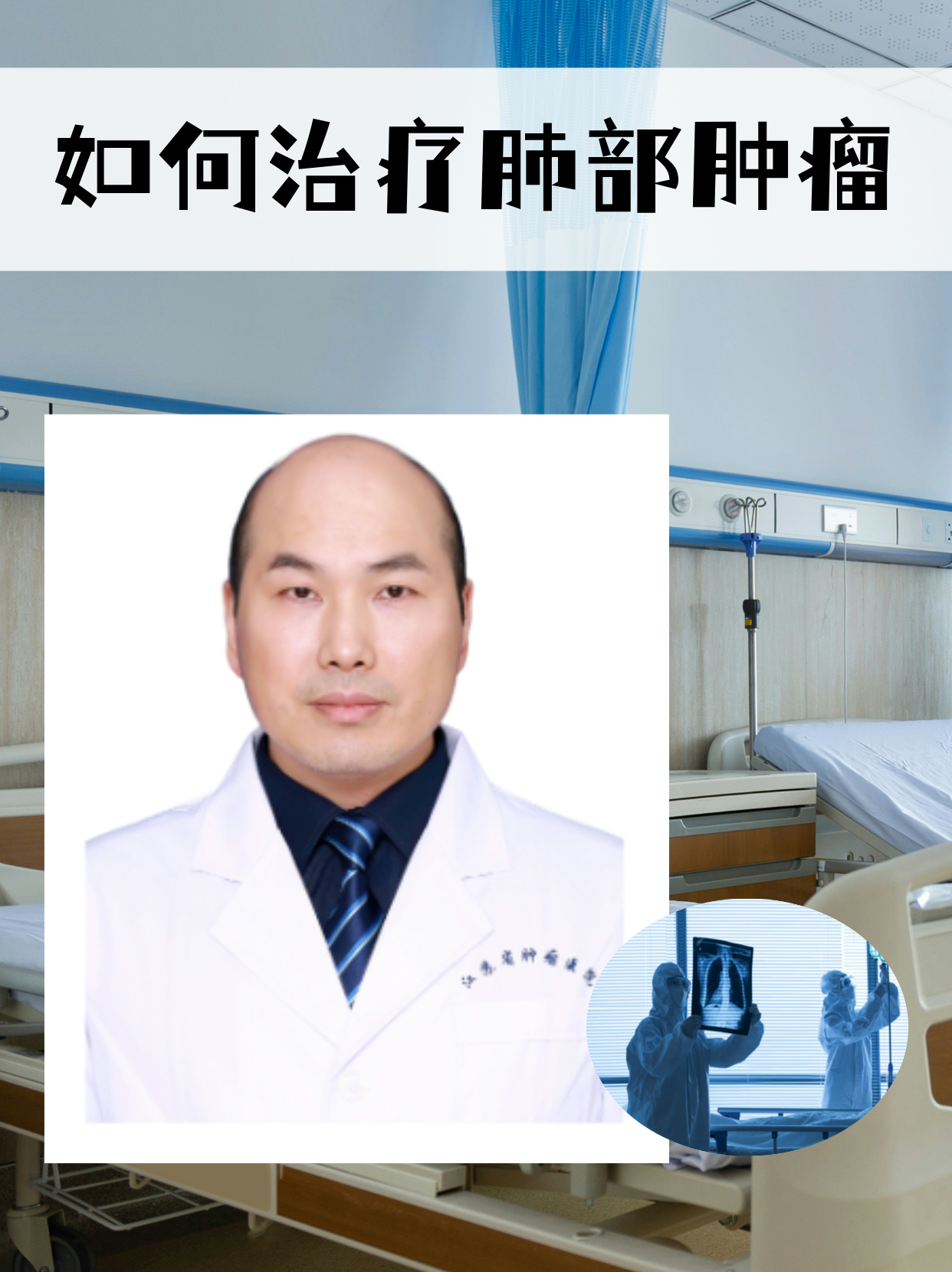 如何治疗肺部肿瘤 肺部肿瘤的治疗是一个复杂而个体化的过程,需要根据