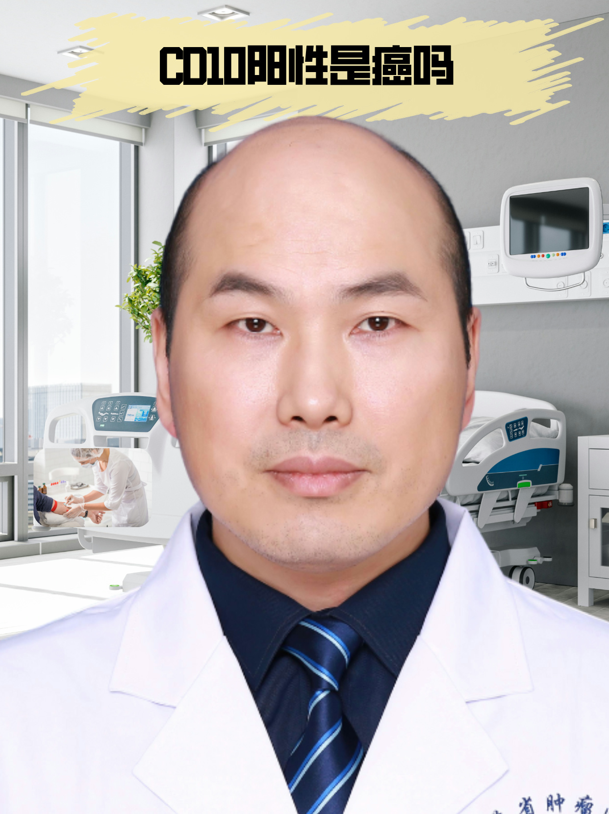 cd10是一种细胞表面蛋白,也称为共同抗原,它在正常