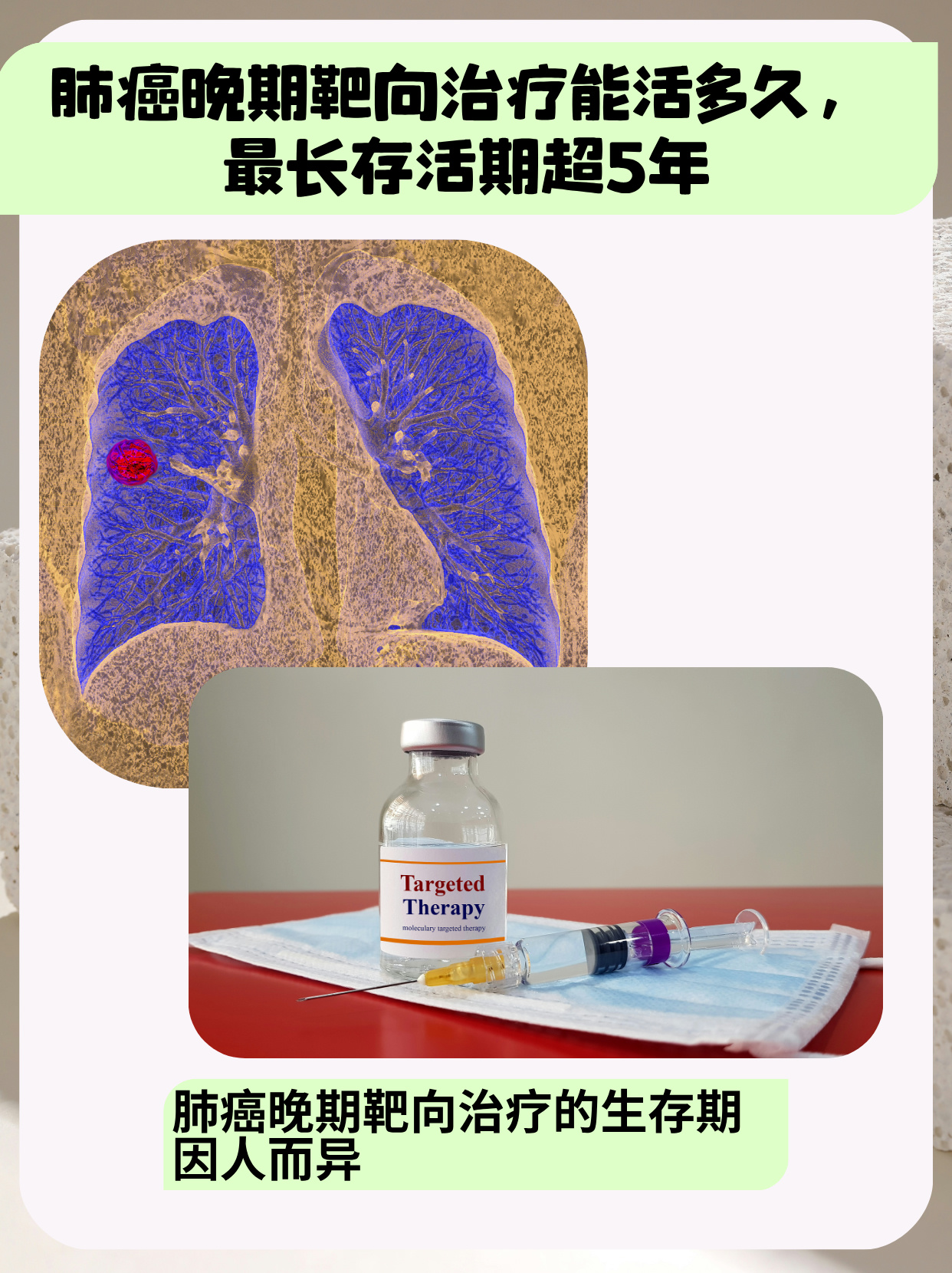 今天就来跟大家分享一些关于肺癌晚期靶向治疗的知识,希望能给面临