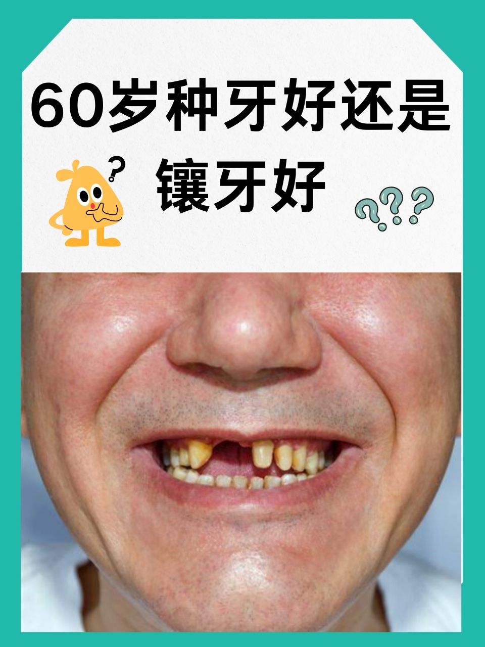 60岁种牙好还是镶牙好