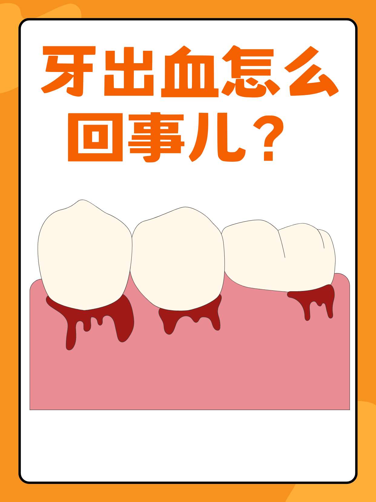 为什么牙龈经常出血是什么原因