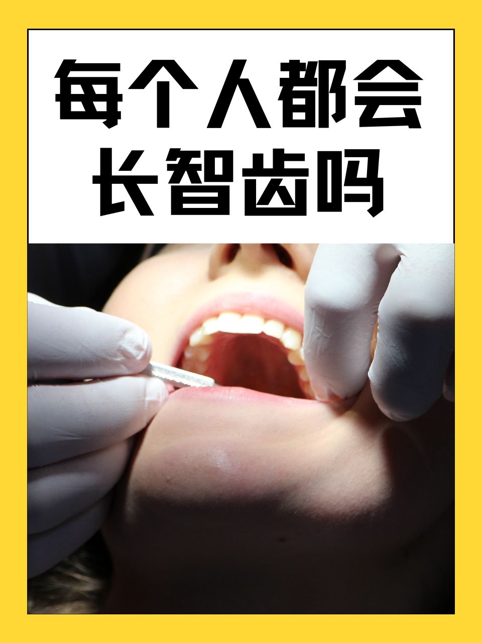 拔牙多少钱一颗牙价格表为什么在线