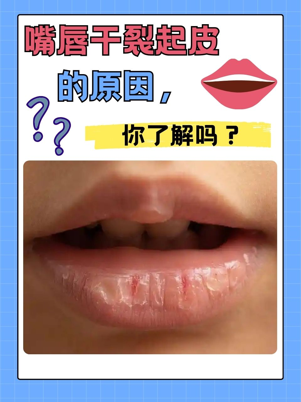 为什么嘴巴会干枯百科在线