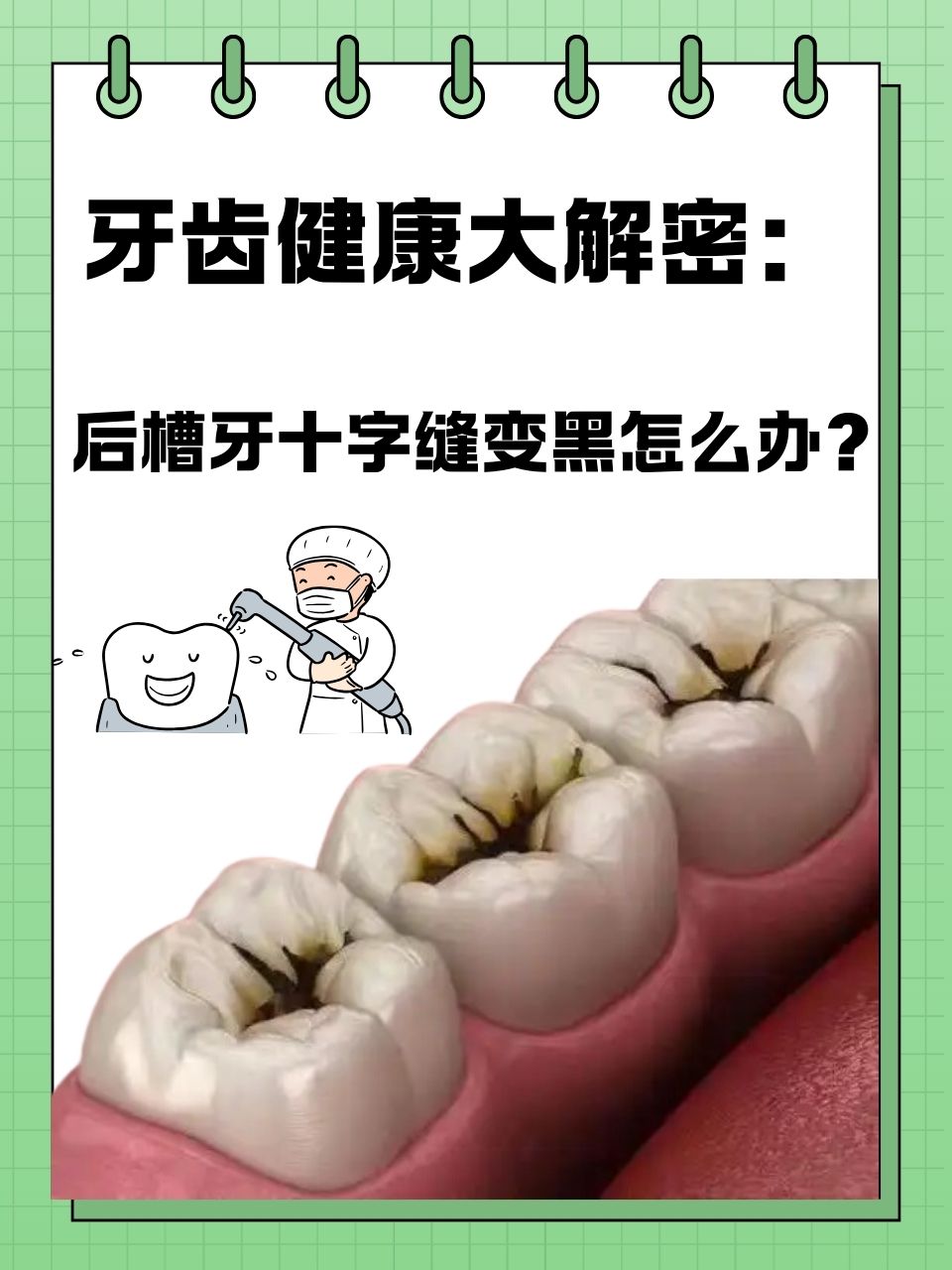 还直接影响到我们的笑容和自信牙齿坏死变黑图片牙齿中间黑缝怎么去除