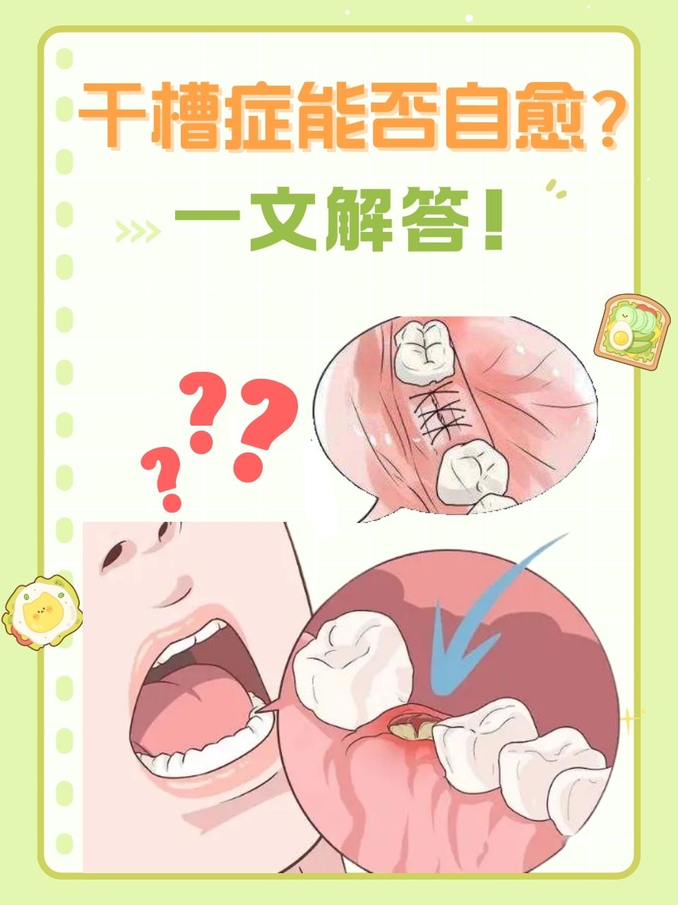 本文将从可以和不可以两方面进行分析,并介绍预防干槽症的方法以及日