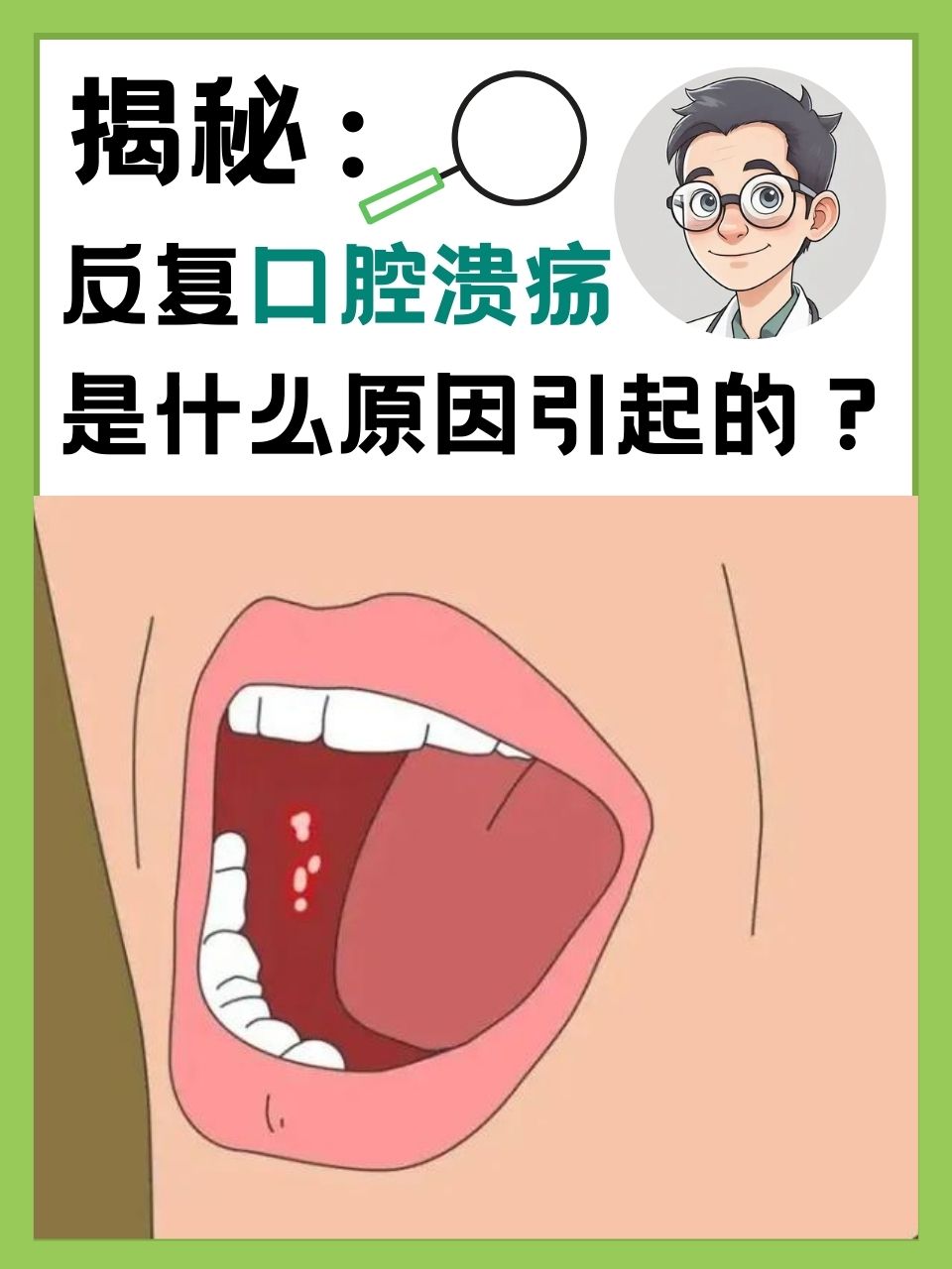为什么会经常性口腔溃疡