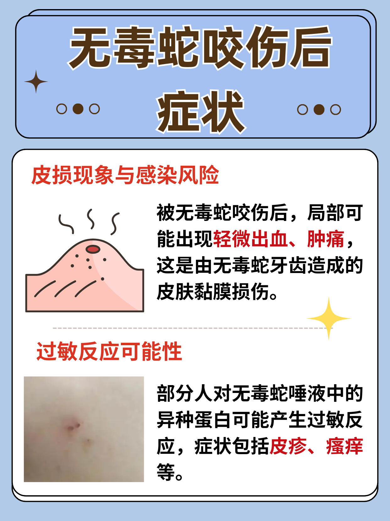 蛇会无缘无故的咬人吗