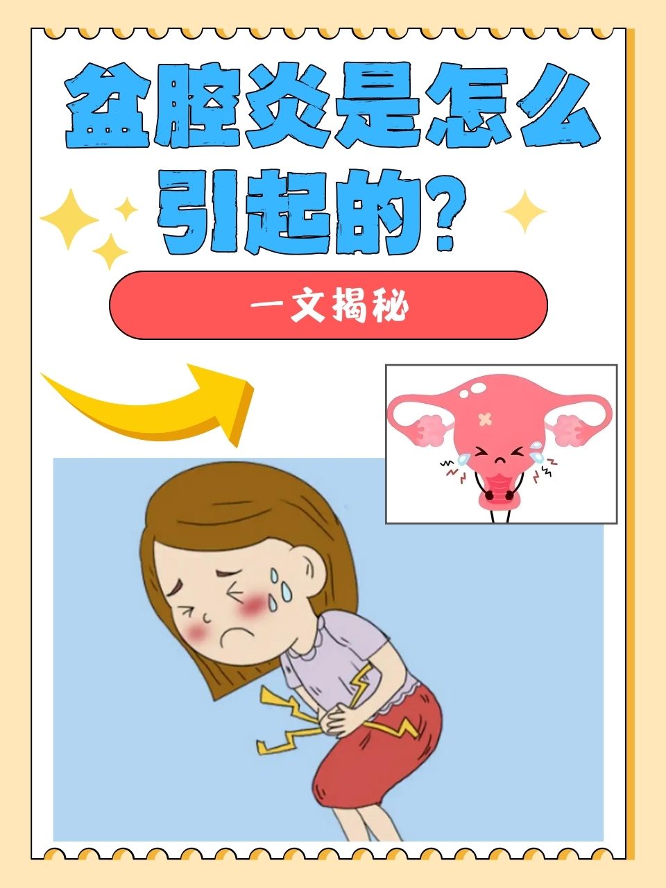 一文揭秘  在女性的健康领域,盆腔炎是一个不容忽视的问题