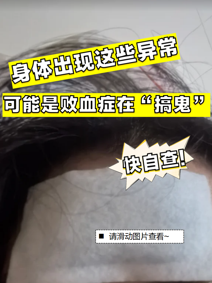 当身体毫无征兆地出现哪些异常情况,可能是败血症在作祟呢?