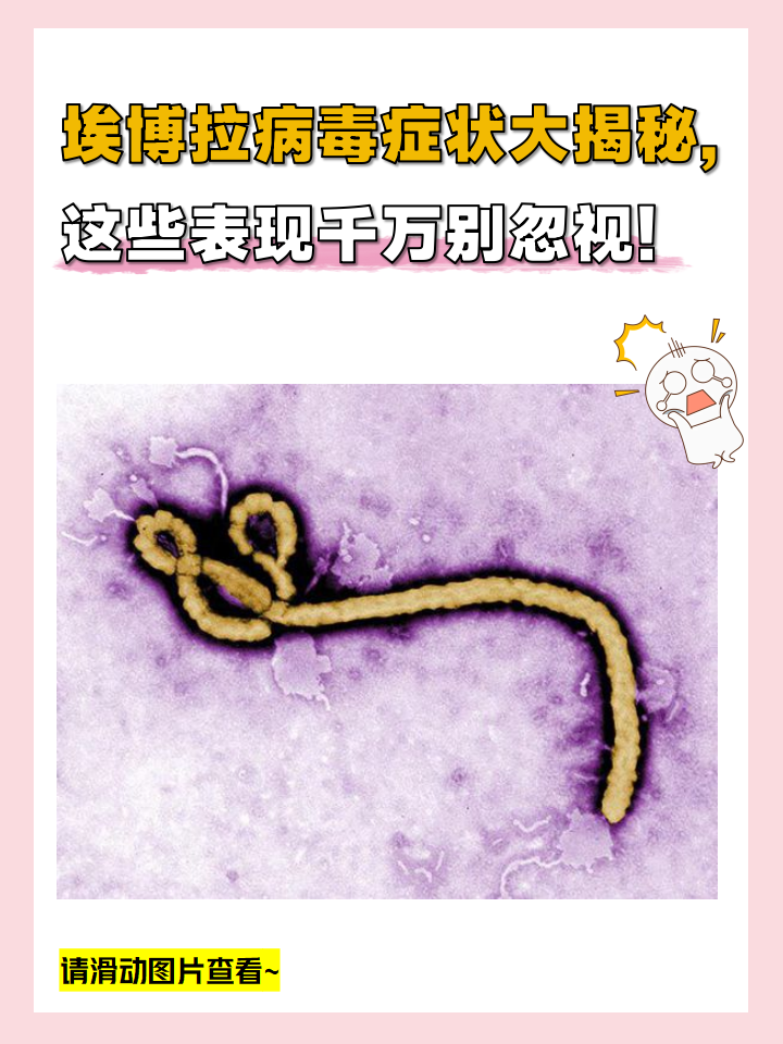 埃博拉病毒一旦发作后果不堪设想,它有哪些症状呢?你知道吗?