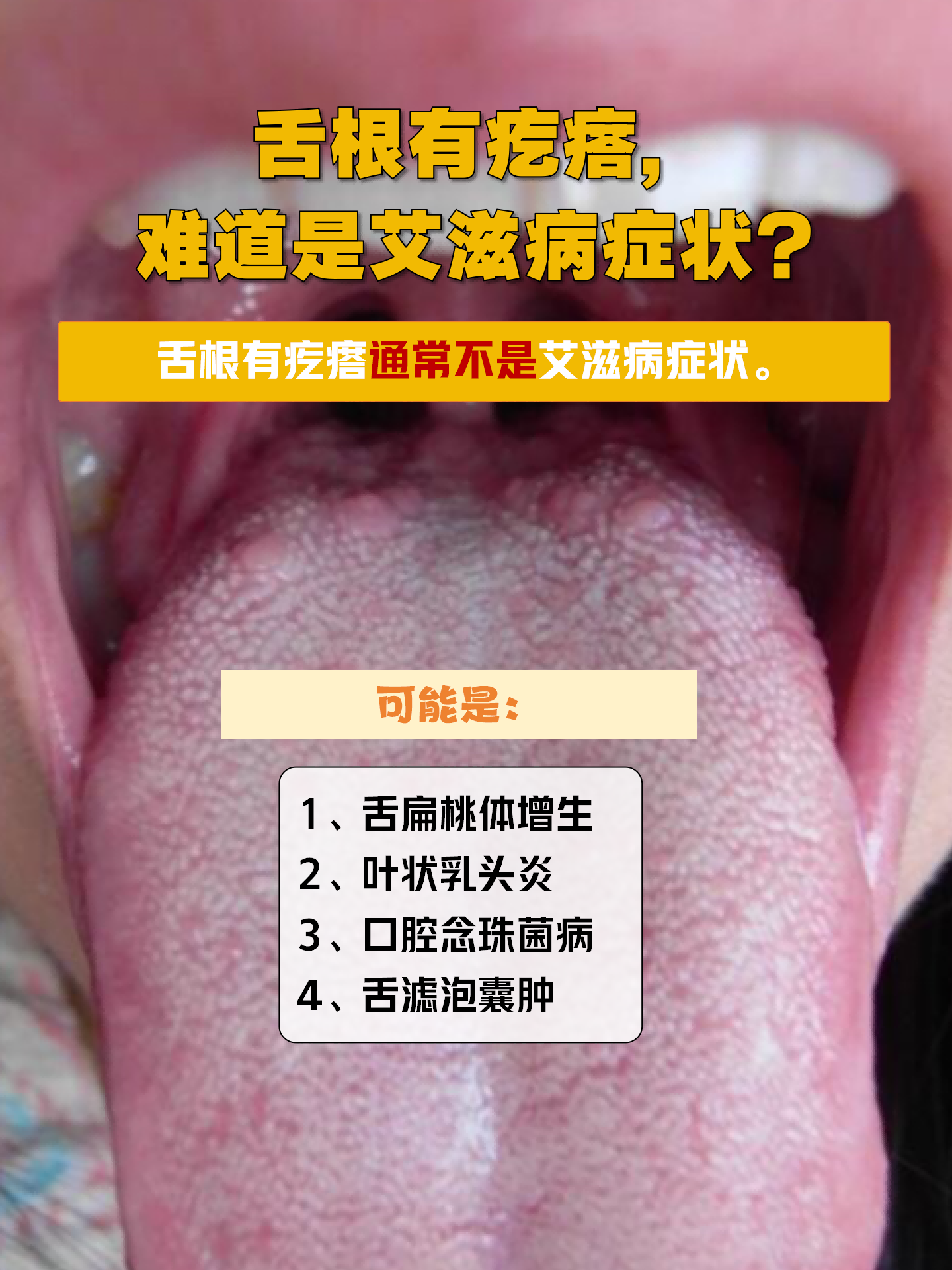 别慌,下面为你一探究竟