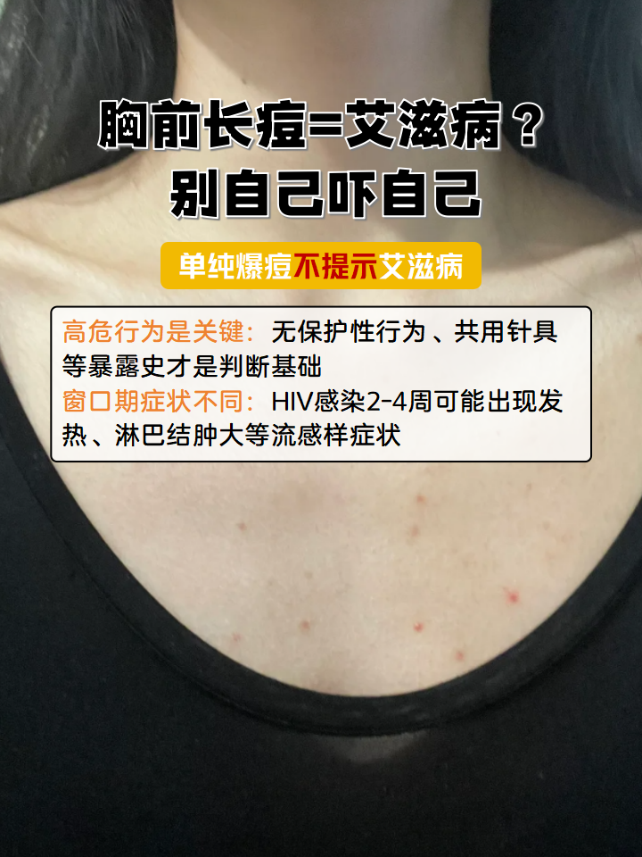 胸前长痘=艾滋病?