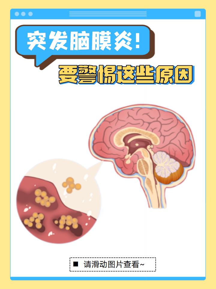 脑膜炎的病因化脓性脑膜炎图片手绘图脑膜炎卡通脑膜炎科普图新生儿