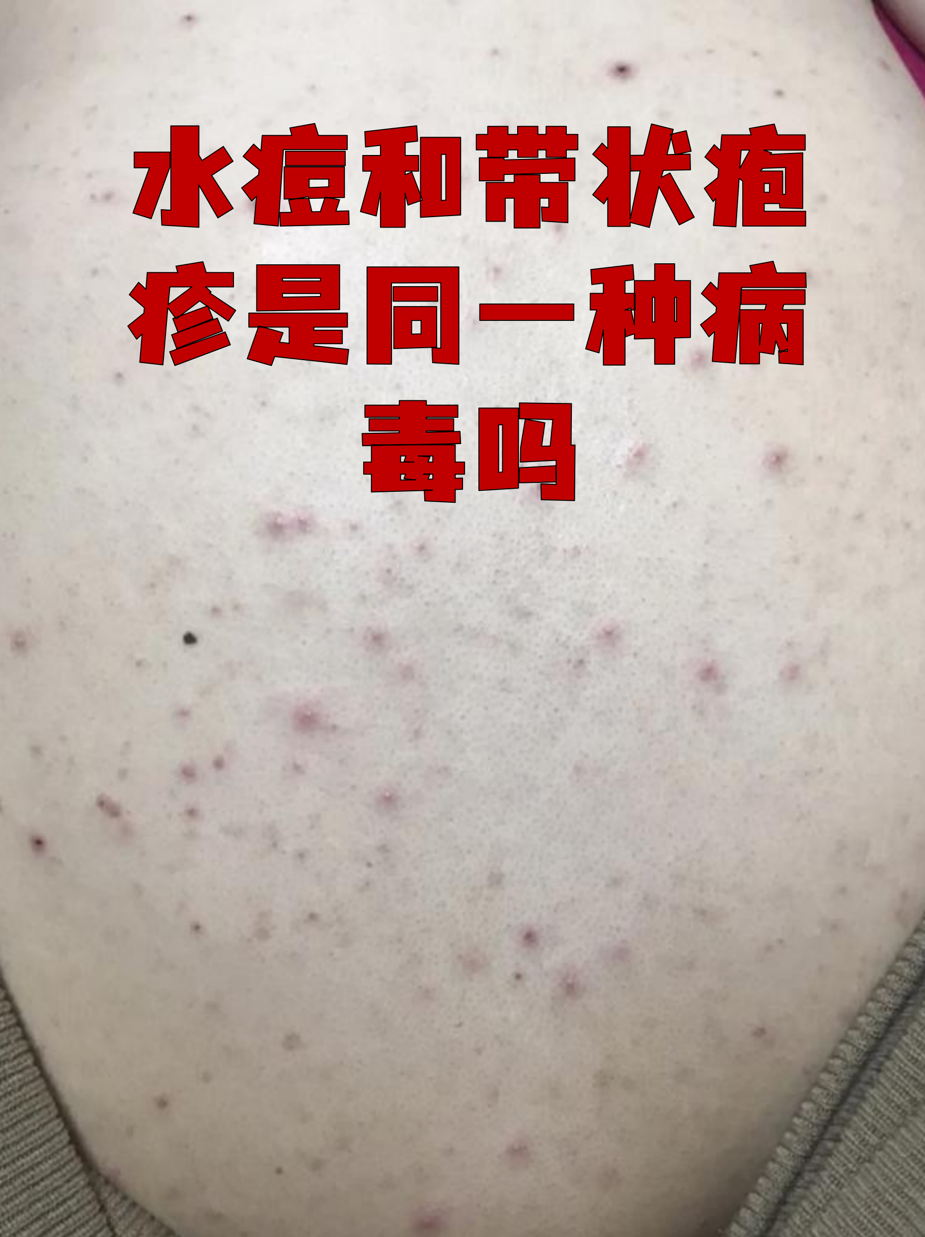  疫情的传染源是什么物质(武汉疫情传染源)