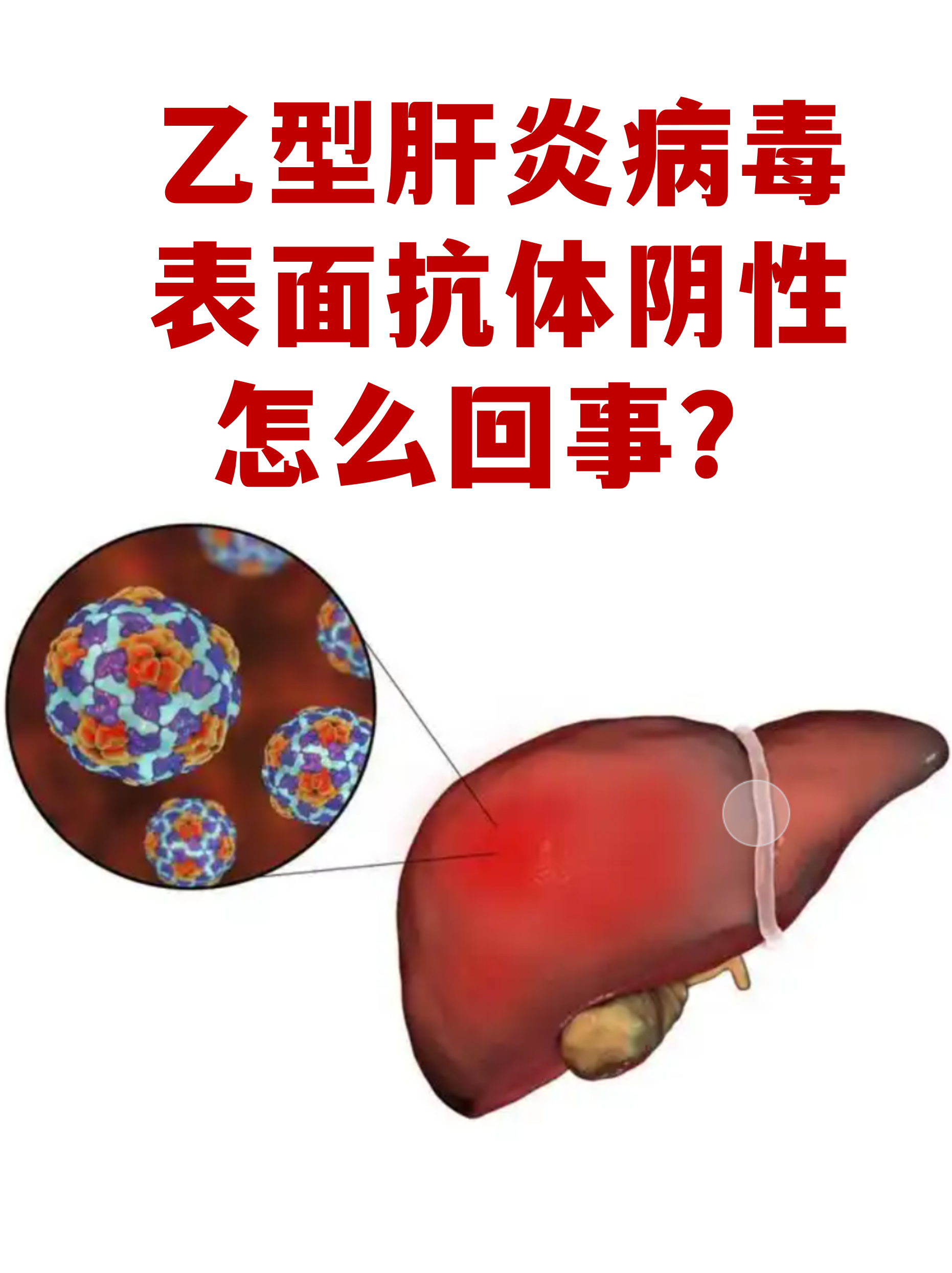  现在的病毒是什么情况(现在的病毒是什么情况引起的)