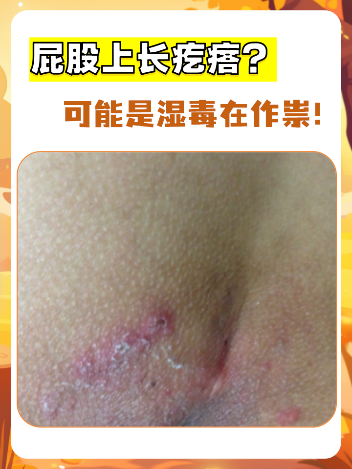 一个有点尴尬却又不得不重视的问题