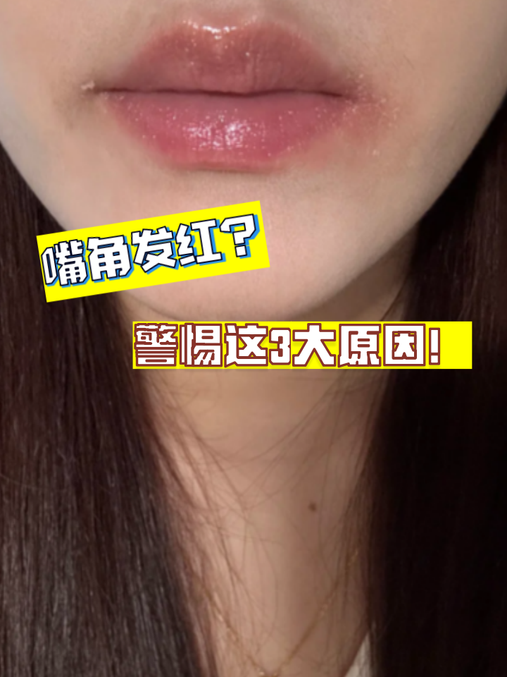 可能有以下几个: 过敏 口