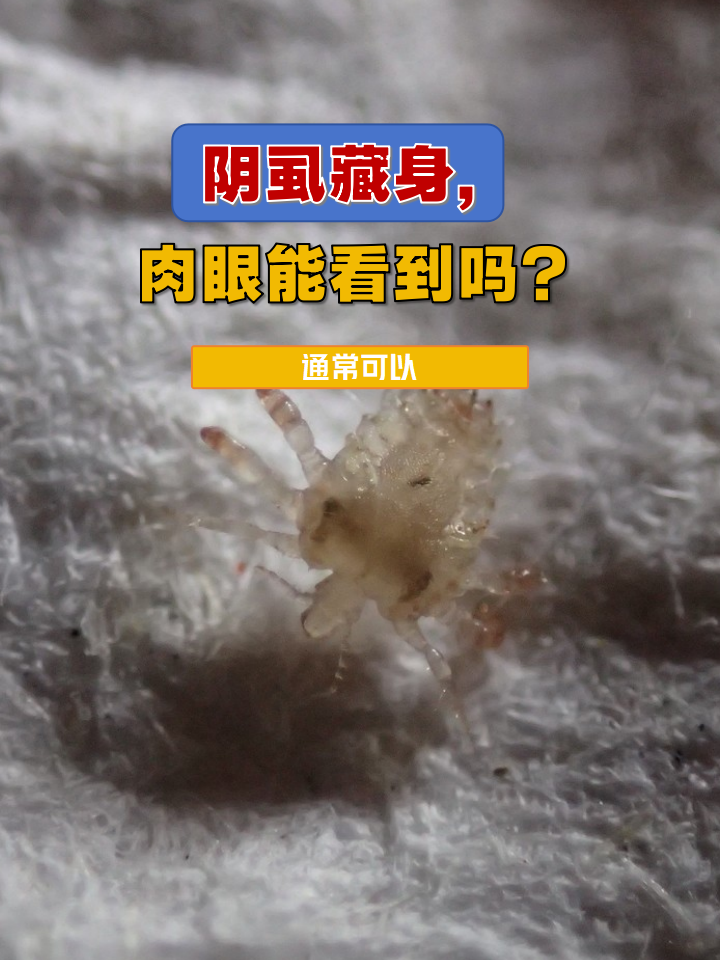阴虱藏身,肉眼能看到吗?