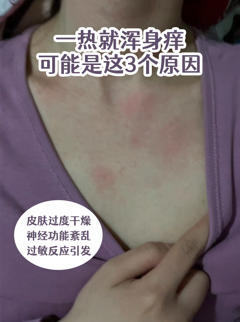 换床单后为什么浑身痒百科在线 换床单后为什么浑身痒百科在线