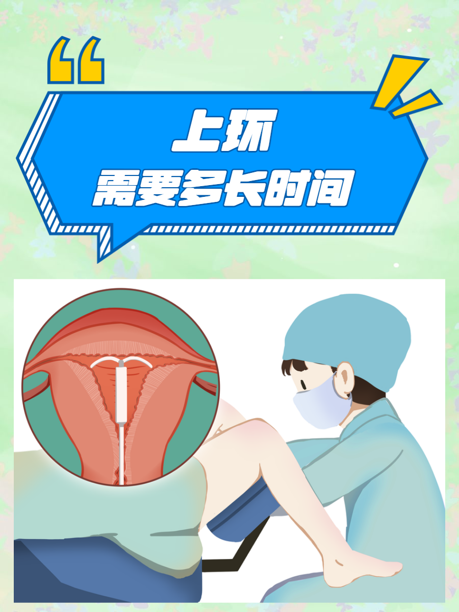 上环需要多长时间?一文为你解答