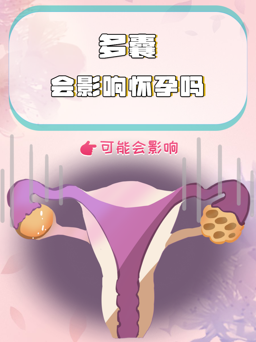 多囊为什么不容易怀孕 多囊为什么不容易怀孕