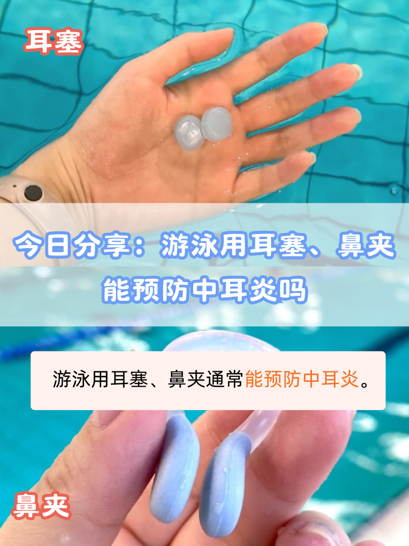 今日分享:游泳用耳塞,鼻夹能预防中耳炎吗  夏季炎热的时候,游泳是