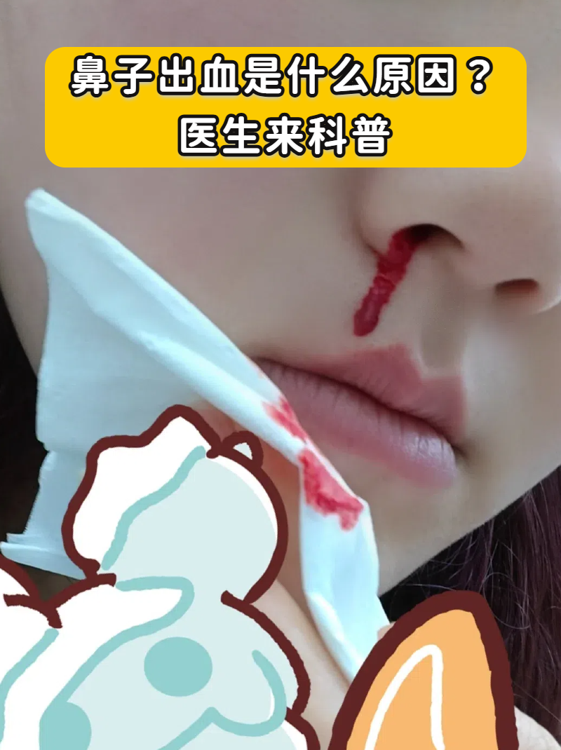 为什么鼻子会流血不止百科在线
