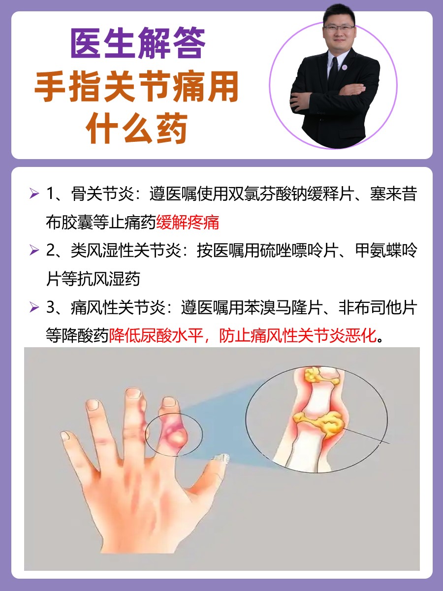 为什么手指痛 为什么手指痛