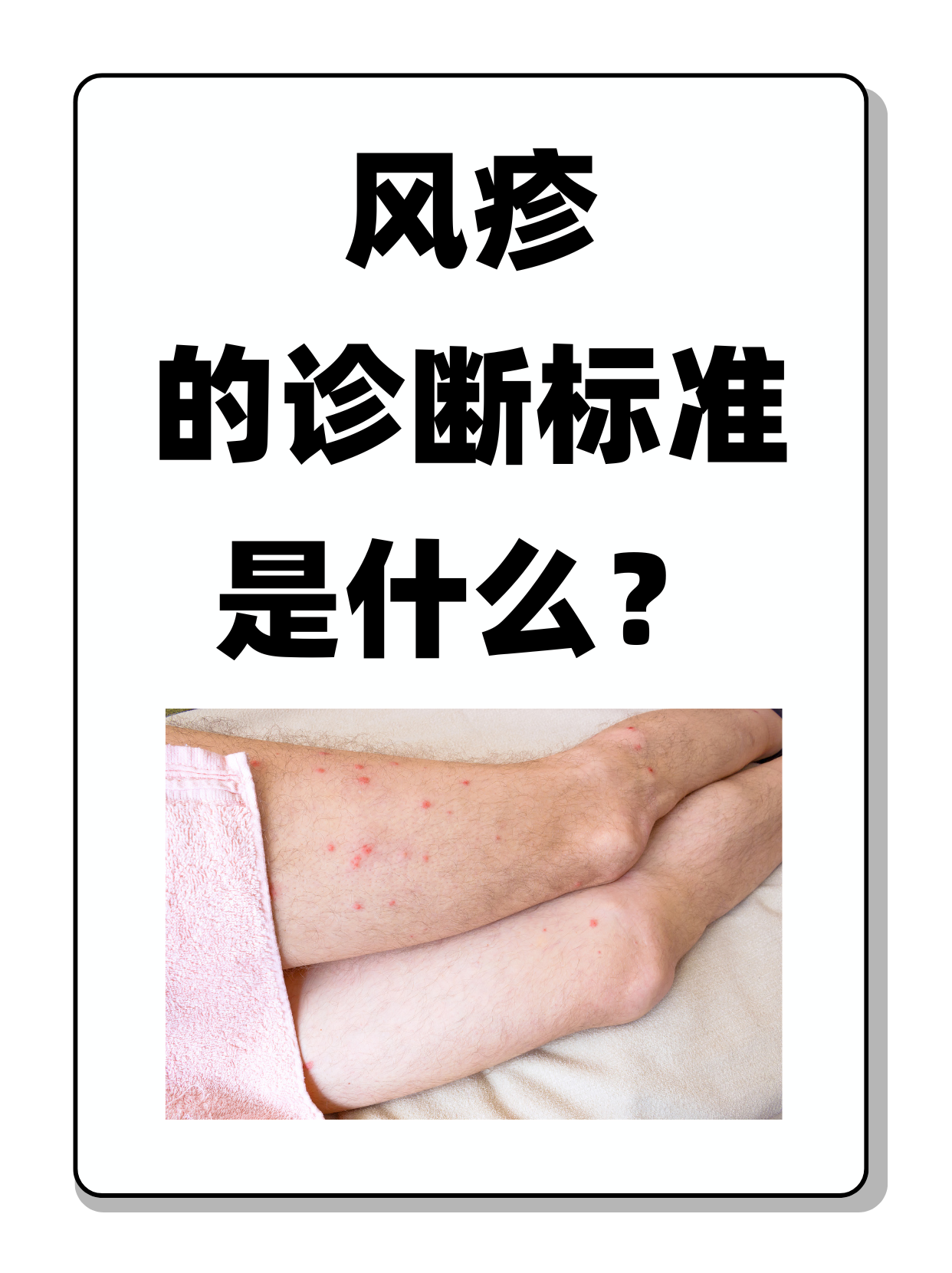 风疹,又称德国麻疹,是一种由风疹病毒引起的急性传染病