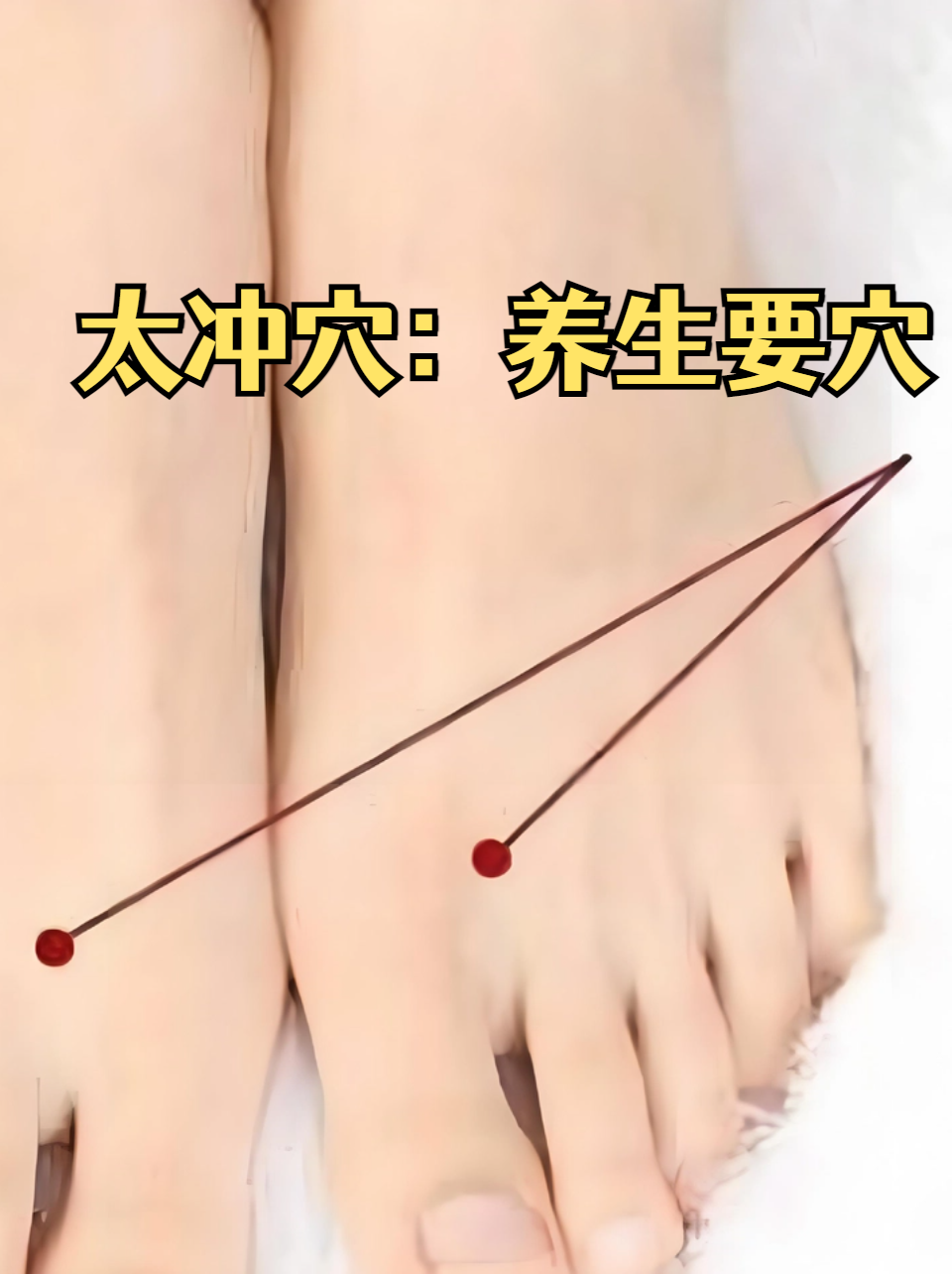 太冲穴:养生要穴 太冲穴作为中医养生中的重要穴位,主要位于足背侧,与