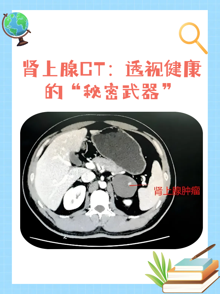 肾上腺ct:透视健康的"秘密武器" 肾上腺ct,是一种先进的医学影像检查