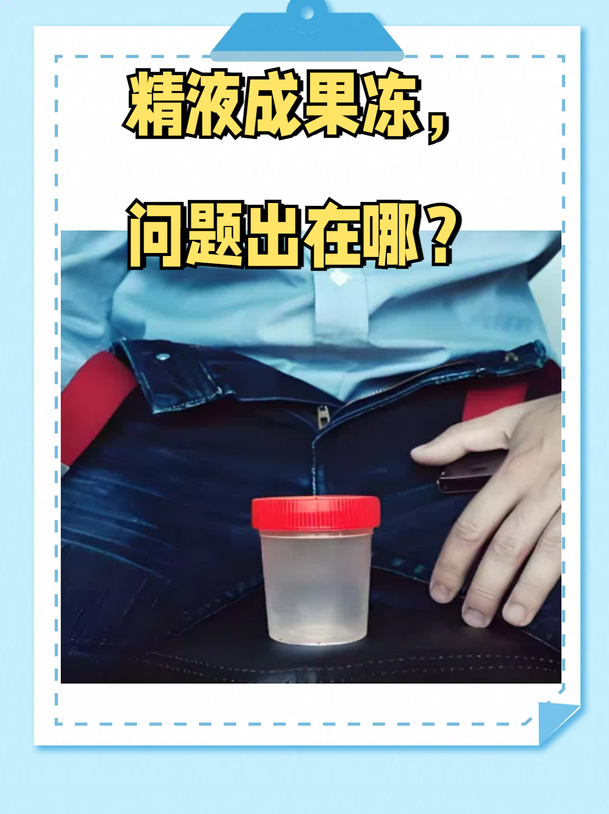 精子为什么是黄色的为什么在线 精子为什么是黄色的为什么在线