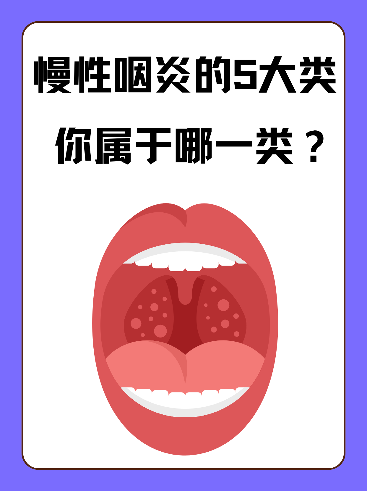 嗓子发炎为什么