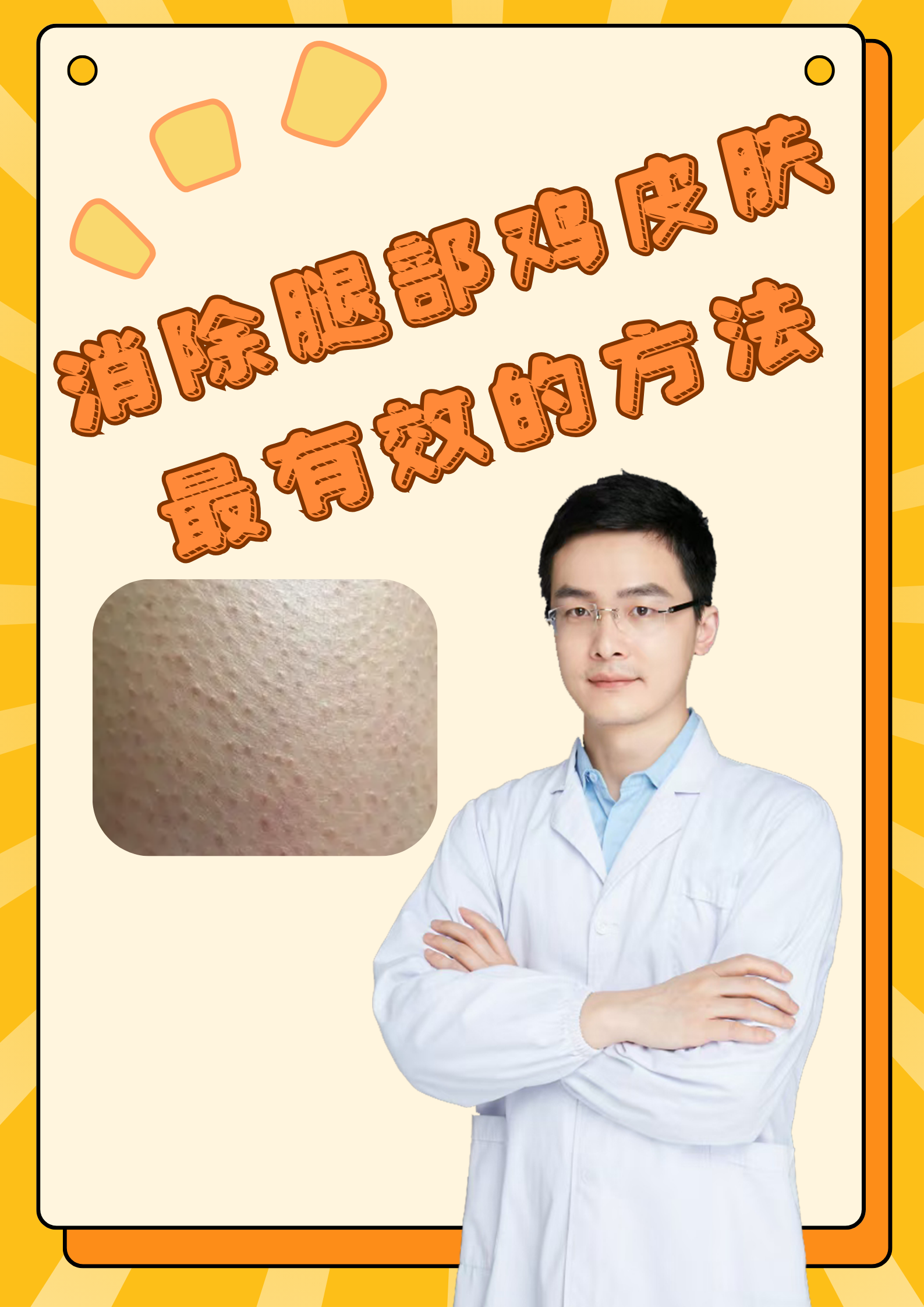 消除腿部鸡皮肤最有效的方法