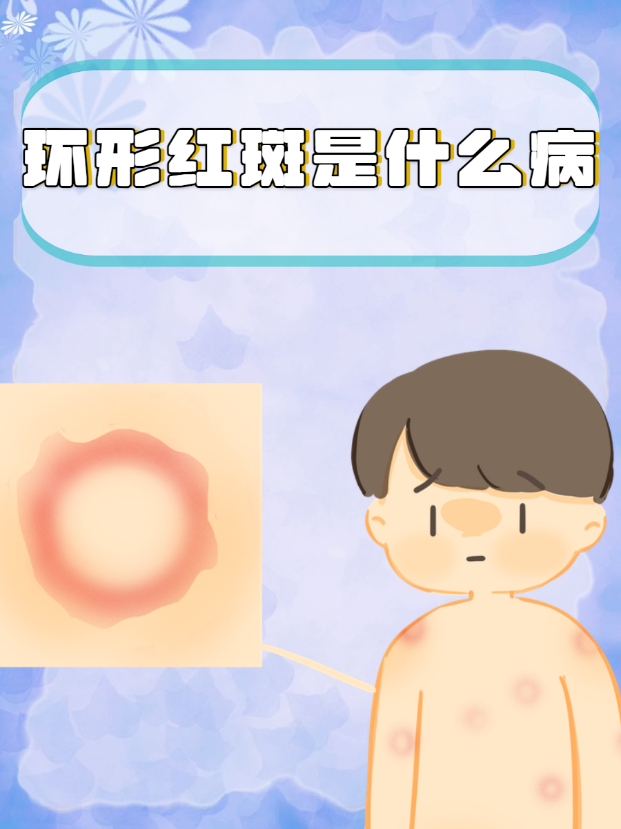 很多人在日常生活中可能会遇到各种皮肤问题,其中