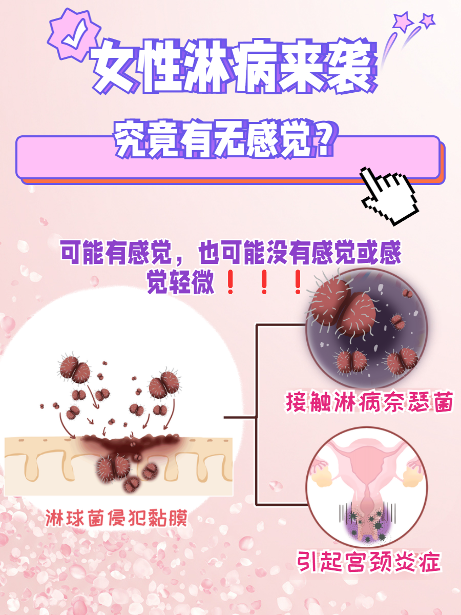 女性淋病来袭,究竟有无感觉?一文揭秘!