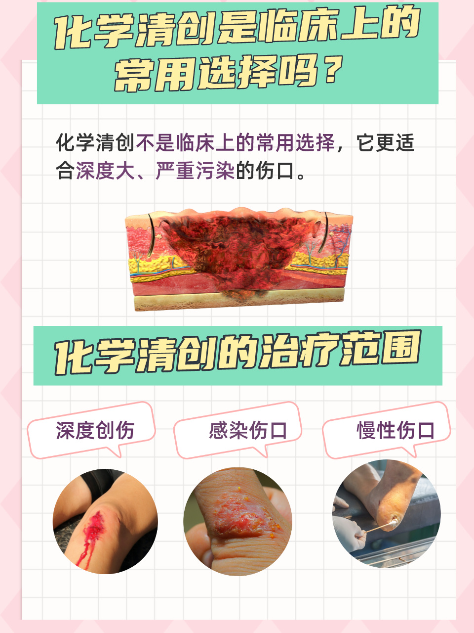 化学清创:临床上的常用选择吗?