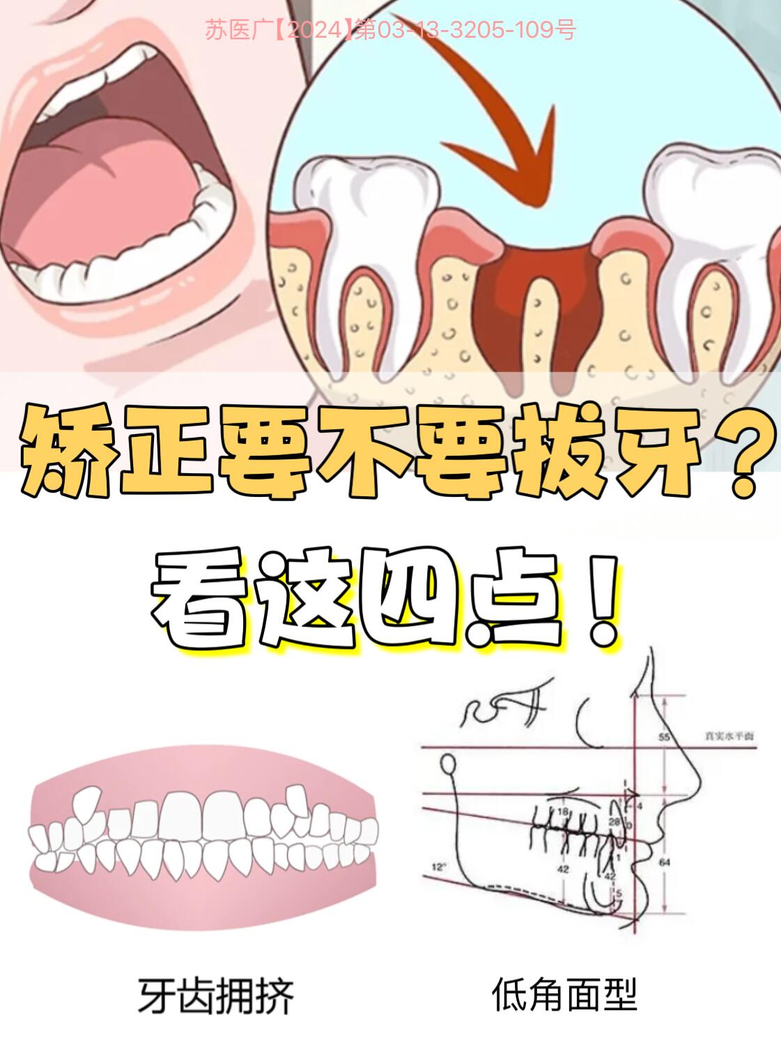 牙床歪了怎样复位图图片